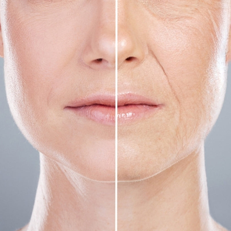 Anti-Aging
